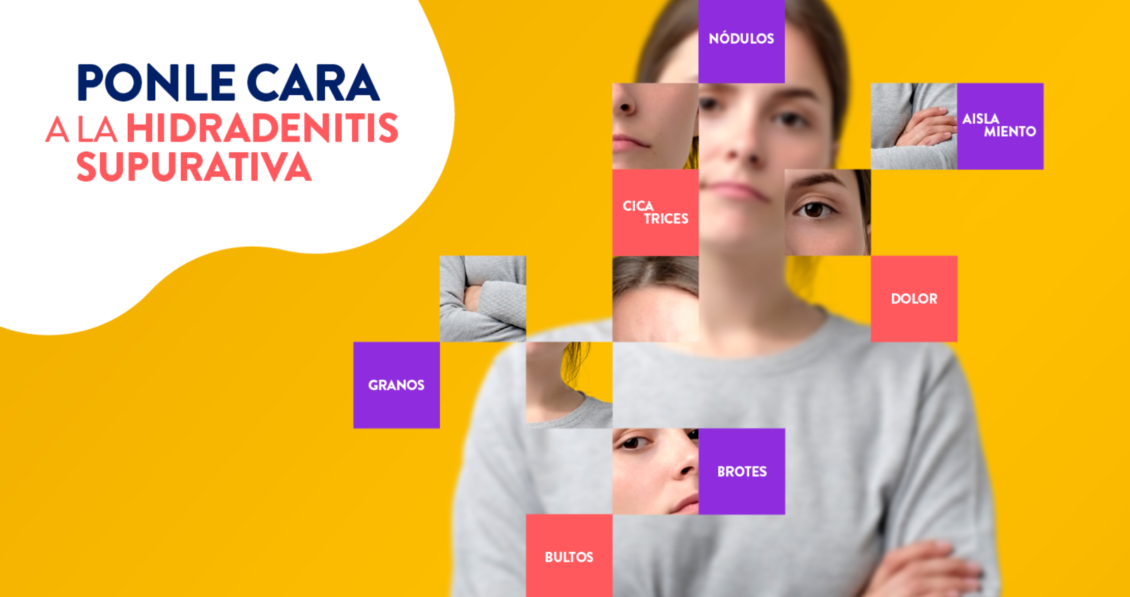Ponle cara a la hidradenitis supurativa