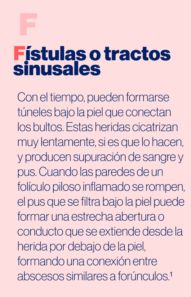 Fístulas o tractos sinusales